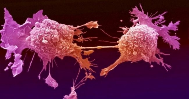 Ученые из России обучили ультразвук находить и убивать раковые клетки - «Непознанное»