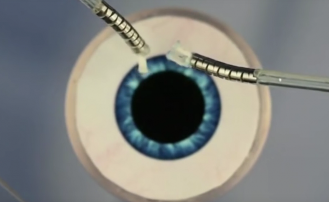 Робот-микрохирург с тентаклями поможет с операциями на глазах - «Новые технологии»