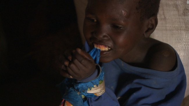 Вот уже полвека загадочная болезнь превращает африканских детей в «овощей» (10 фото) - «Планета Земля»