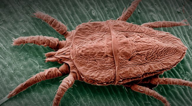 10 ужасных паразитов, способных вас убить (10 фото) - «Планета Земля»
