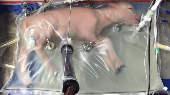 Учёные создали искусственную матку для недоношенных детей (2 фото + видео) - «Новые технологии»